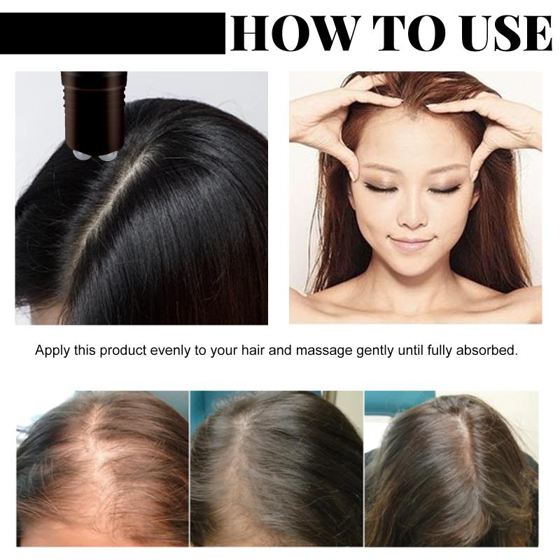 Batana Hair Regrowth Serum Ant - Hair Care Oil Serum avaliação e preço